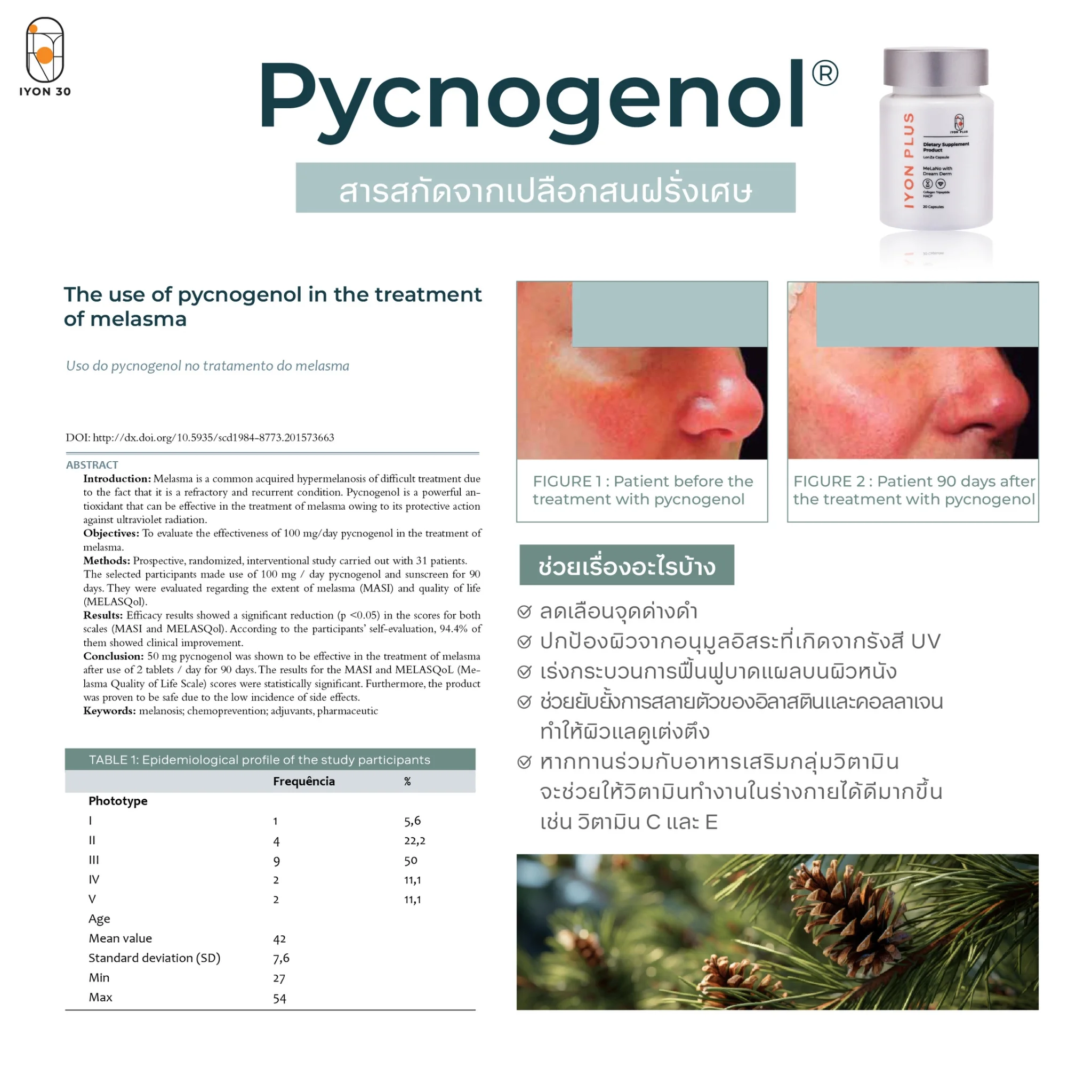 IYON 30 วิตามินล็อคผิว อาหารเสริมผิวใส อิ่มน้ำ Pycnogenol 20 แคปซูล