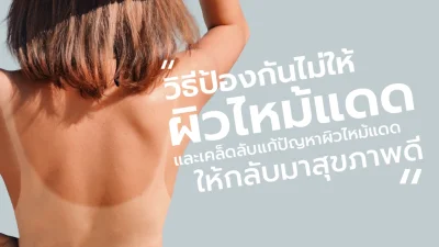 วิธีป้องกันไม่ให้ผิวไหม้แดด และเคล็ดลับแก้ปัญหาผิวไหม้แดดให้กลับมาสุขภาพดี