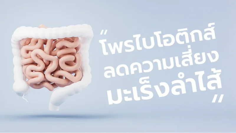 โพรไบโอติกส์ลดความเสี่ยงมะเร็งลำไส้จริงหรือ