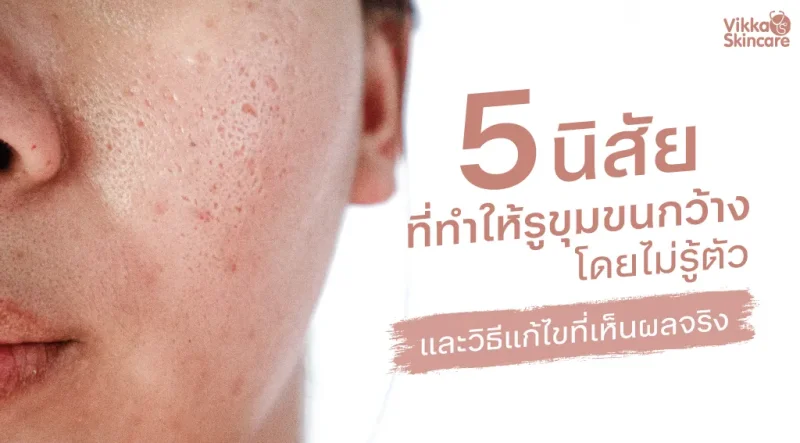 5 นิสัยที่ทำให้ รูขุมขนกว้าง โดยไม่รู้ตัว และวิธีแก้ไขที่เห็นผลจริง
