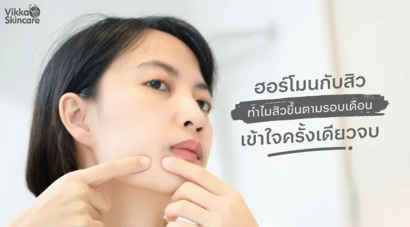 ฮอร์โมนกับสิว ทำไมสิวขึ้นตามรอบเดือน เข้าใจครั้งเดียวจบ